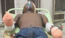 Ấn Độ: Ông bố chặt tay kẻ cưỡng hiếp con gái 7 tháng tuổi