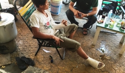 Va chạm giao thông, nam thanh niên bị 2 người đi ôtô đánh gãy tay