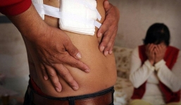 Người đàn ông mất quả thận sau khi phẫu thuật lồng ngực gây sốc