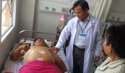 Xương cá dài 3cm đâm thủng ruột non bệnh nhân nặng 110kg