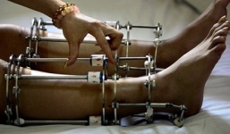 Lò đập xương, kéo chân bạc tỷ tại Ấn Độ