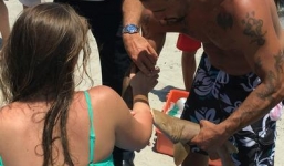 Cá mập cắn ngập tay cô gái trẻ tới tận bệnh viện