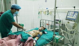 Thủng bụng, mất ngón tay vì đèn pin phát nổ