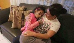 Cô gái bị tổn thương não sau khi nâng ngực