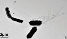 'Thủ phạm' gây ra bệnh Alzheimer có thể biến con người thành 'Siêu Nhân'