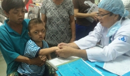  Ba cha con mắc bệnh 'lạ': Cùng dị tật 6 ngón, mắt lồi không thể khép khi ngủ