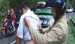 Nhóm thanh niên đâm tài xế taxi trọng thương sau va chạm giao thông