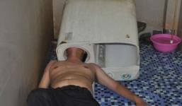 Nam thanh niên bị máy giặt 'nuốt chửng' đầu may mắn sống sót