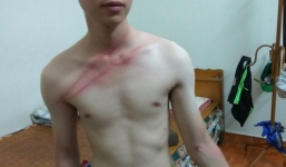 Nhân viên tố bị chủ tiệm sửa máy tính dùng dây điện vụt