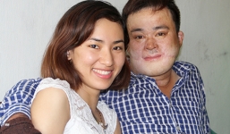 Chuyện tình cô gái xinh đẹp và chàng trai mặt biến dạng vì bỏng gas ở Hà Tĩnh