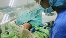 Bé trai sơ sinh có ruột nằm ngoài ổ bụng đã được phẫu thuật thành công