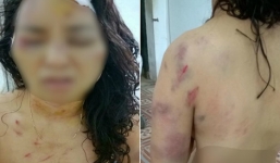 Nữ giáo viên bị chồng cũ bạo hành như thời trung cổ