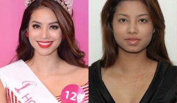 Hoa hậu, Á hậu Việt và nghi án phẫu thuật thẩm mỹ
