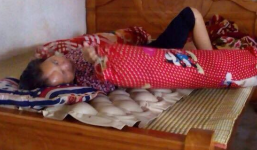 Tai nạn giao thông 3 tháng, nạn nhân vẫn chưa 'biết' nguyên nhân