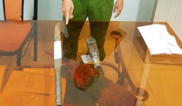 Chủ tịch Hội ND TP. Bạc Liêu bị côn đồ chém đã tử vong sau 15 ngày nhập viện