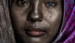 Chùm ảnh: Cô gái Việt có đôi mắt hai màu kỳ lạ trên báo nước ngoài