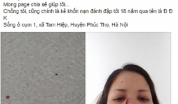 Câu chuyện chồng đánh vợ như kẻ thù suốt 18 năm, khiến dân mạng phẫn nộ 