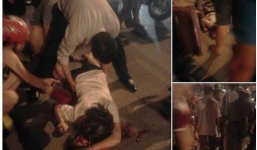 Lại 1 cô gái suýt chết khi trở thành nạn nhân của cướp giật túi xách