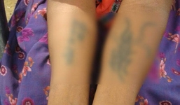 Bị gia đình chồng cưỡng bức, xăm tục tĩu lên người vì không đủ của hồi môn