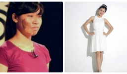 Cô gái dân tộc Sán Dìu hóa hotgirl xinh đẹp nhờ phẫu thuật thẩm mỹ