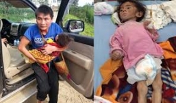 Bé gái 14 tháng tuổi nặng 3,5 kg vì bị bỏ đói ở Sapa: Chính quyền xã lên tiếng