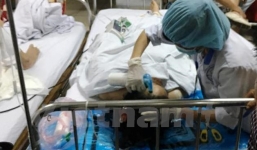 Hà Nội: Gã chồng vũ phu chém vợ đứt lìa 4 ngón tay