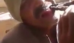 Màn nhổ răng bằng kìm khiến bệnh nhân tái mặt