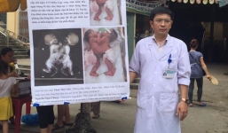 Phó Giám đốc BV ra chợ xin tiền cứu cặp song sinh dính liền ở Hà Giang