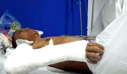 Hà Nội: Đang uống nước, nam thanh niên bị hàng chục côn đồ truy sát