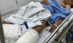 Bệnh viện Việt Đức mổ nhầm chân bệnh nhân, thu 2 lần tiền phẫu thuật