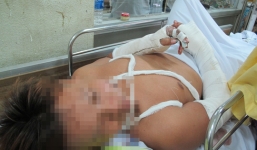 Đàn em trùm giang hồ Năm Cam cầm đầu vụ truy sát 2 người trong BV Quốc Ánh