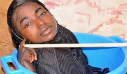 Hy hữu cô gái sống trong chậu nhựa vì căn bệnh lạ