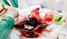 Thai phụ được mổ khẩn cấp, không kịp làm hồ sơ bệnh án và hội chẩn