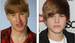 Nguyên nhân tử vong của ngôi sao phẫu thuật giống Justin Bieber