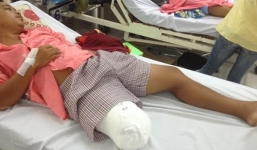 Vụ bệnh nhân bị cưa chân ở TP HCM: Bộ Y tế vào cuộc