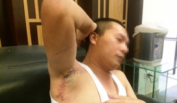 Giám đốc bị bắn: 'Máu chảy rất nhiều nhưng tôi vẫn phải nằm im giả chết'