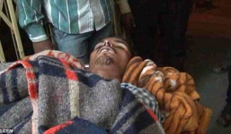 Cái kết của người đàn ông bị rắn cắn chết, “hồi sinh” trên giàn hỏa thiêu