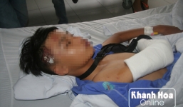 Thiếu niên 15 tuổi bị côn đồ truy sát, chém gần đứt lìa cánh tay