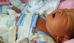 Làm gãy chân trẻ sơ sinh, bác sĩ bảo do dị tật 