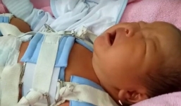 Bộ Y tế yêu cầu kỷ luật bác sĩ làm gãy chân trẻ sơ sinh