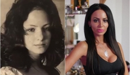 Ghét mẹ, cô gái phẫu thuật thay đổi hoàn toàn khuôn mặt