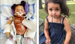 Những cô bé gặp nạn vẫn vượt khó theo đuổi đam mê