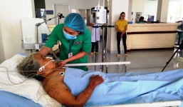 Hy hữu: Cụ bà bị ong vò vẽ đốt 200 mũi