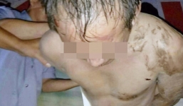 Trung Quốc: Phụ huynh quây đánh, lột trần thầy giáo vì nghi cưỡng hiếp học sinh