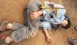 Trộm chó bị đánh gãy 2 tay, 2 chân