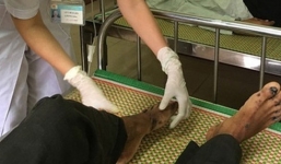 'Bệnh lạ” tái xuất tại Quảng Ngãi: Bộ Y tế yêu cầu giám sát chặt chẽ