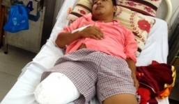 Bị cưa chân nhầm, bệnh nhân gửi đơn cầu cứu đến Bộ trưởng Bộ Y tế