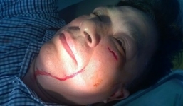 Không chịu “làm luật”, một giám đốc bị chặn đường đập gạch rách mặt