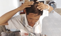 Tình tiết bất ngờ vụ chồng đổ nước sôi vào tai vợ