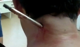 Video: Người đàn ông bị lao xuyên từ cổ qua vai khi bắt cá